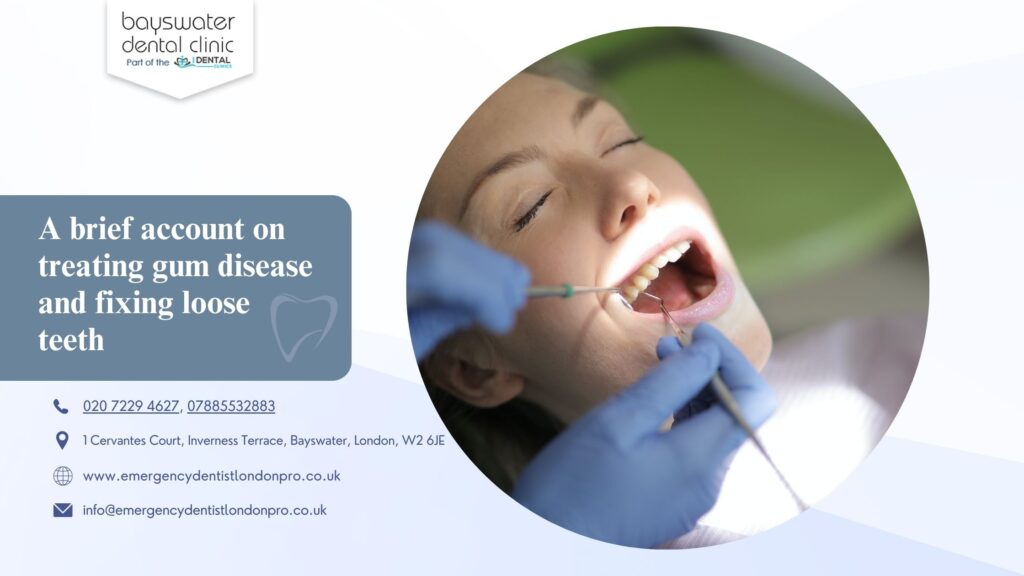 A brief account on treating gum disease and fixing loose teeth